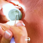 Ear wax removal by microsuction at Meadows & Wood
